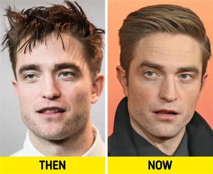 Why Doesn't Robert Pattinson Have Instagram?